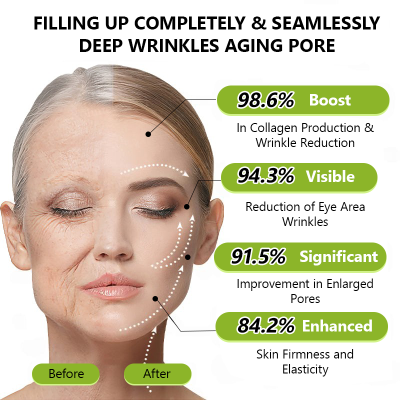 👩‍⚕️Made and shipped from NZ 🛒Healrize® Botox & Vita-A Retinol Shot Wrinkle-Lift Tightening cream - Last Day Promotion 70% OFF🛒