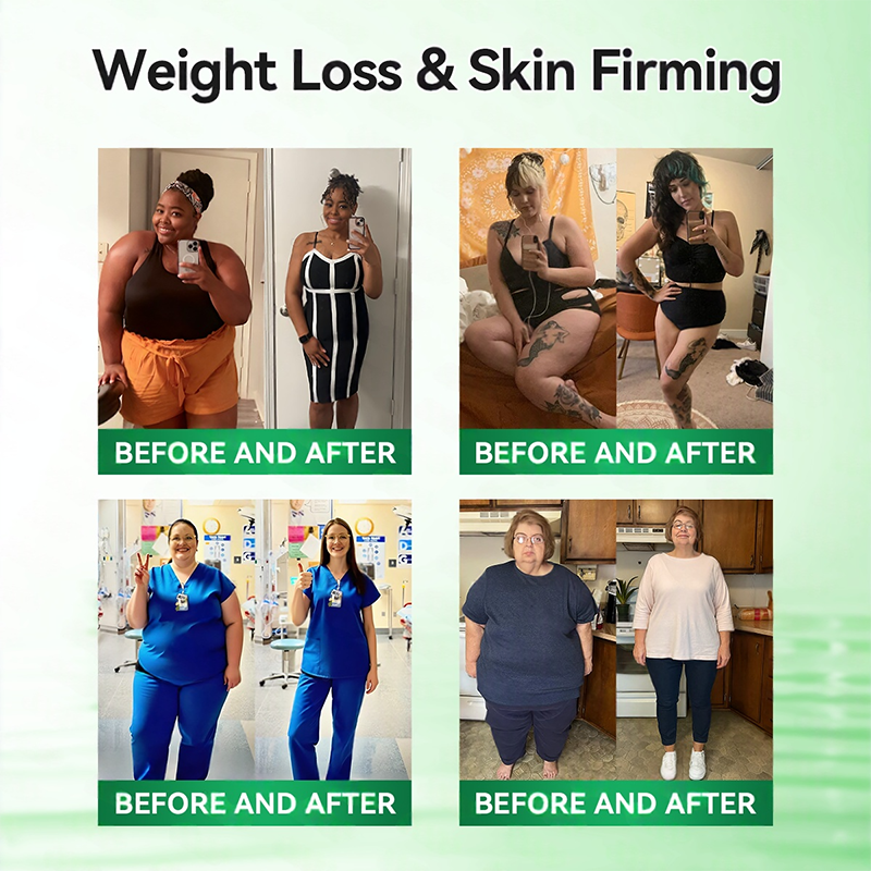 𝑶𝒇𝒇𝒊𝒄𝒊𝒂𝒍 𝑺𝒕𝒐𝒓𝒆  |H𝐞a𝐥r𝐢z𝐞® 1𝟐-𝐈N-1 M𝐨r𝐢n𝐠a * B𝐞r𝐛e𝐫i𝐧e * N𝐀D+ 𝐀d𝐯a𝐧c𝐞d N𝐚n𝐨 𝐌i𝐜r𝐨n𝐞e𝐝l𝐞 𝐏a𝐭c𝐡 (𝐎𝐧𝐜𝐞 𝐃𝐚𝐢𝐥𝐲, 𝐯𝐢𝐬𝐢𝐛𝐥𝐞 𝐜𝐡𝐚𝐧𝐠𝐞𝐬 𝐢𝐧 𝟕 𝐝𝐚𝐲𝐬）F𝐨r 𝐎𝐛𝐞𝐬𝐢𝐭𝐲, 𝐋o𝐨s𝐞 𝐒k𝐢n, 𝐃𝐢𝐚𝐛𝐞𝐭𝐞𝐬, 𝐒𝐥𝐞𝐞𝐩 𝐀𝐩𝐧𝐞𝐚, 𝐀𝐧𝐝 𝐉𝐨𝐢𝐧𝐭 𝐈𝐬𝐬𝐮𝐞𝐬 🗓️🌵