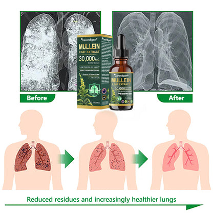 𝗢𝗳𝗳𝗶𝗰𝗶𝗮𝗹 𝗦𝘁𝗼𝗿𝗲:CareRegen® 𝗢𝗿𝗴𝗮𝗻𝗶𝗰 𝗟𝘂𝗻𝗴 𝗖𝗹𝗲𝗮𝗻𝘀𝗶𝗻𝗴 𝗠𝘂𝗹𝗹𝗲𝗶𝗻 𝗟𝗲𝗮𝗳 𝗘𝘅𝘁𝗿𝗮𝗰𝘁 𝗗𝗿𝗼𝗽𝘀 𝐂𝐥𝐢𝐧𝐢𝐜𝐚𝐥𝐥𝐲 𝐩𝐫𝐨𝐯𝐞𝐧, 𝐡𝐢𝐠𝐡𝐥𝐲 𝐜𝐨𝐧𝐜𝐞𝐧𝐭𝐫𝐚𝐭𝐞𝐝 𝐟𝐨𝐫𝐦𝐮𝐥𝐚 𝐭𝐡𝐚𝐭 𝐫𝐞𝐥𝐢𝐞𝐯𝐞𝐬 𝐜𝐨𝐮𝐠𝐡, 𝐩𝐡𝐥𝐞𝐠𝐦, 𝐚𝐬𝐭𝐡𝐦𝐚 & 𝐂𝐎𝐏𝐃 — 𝐛𝐫𝐞𝐚𝐭𝐡𝐞 𝐞𝐚𝐬𝐢𝐞𝐫, 𝐟𝐚𝐬𝐭𝐞𝐫.🚚⭐