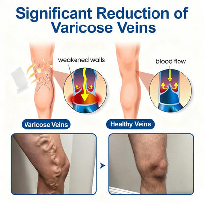 🇳🇿👨‍⚕️👍✅Healrize® VeinTarget Microneedle Patch🎖️Instant Relief, Long-Term Results 🎖️