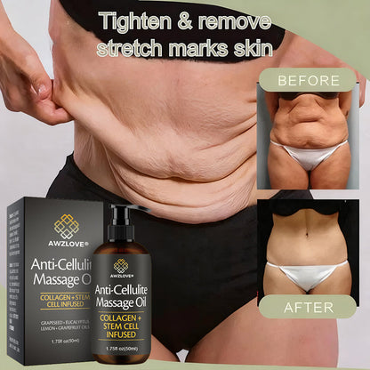 Awzlove® Luxurious Collagen & Stem Cell Anti-Cellulite Massage Oil🎉 (🔥70% Off for a Limited Time!)