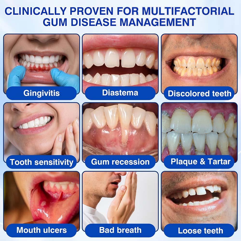 🦷Healrize® GumRevive gel for the regeneration of the tooth-supporting apparatus (for bleeding gums, receding gums, and loose teeth)🎁