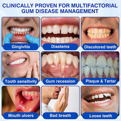 🦷Healrize® GumRevive gel for the regeneration of the tooth-supporting apparatus (for bleeding gums, receding gums, and loose teeth)🎁