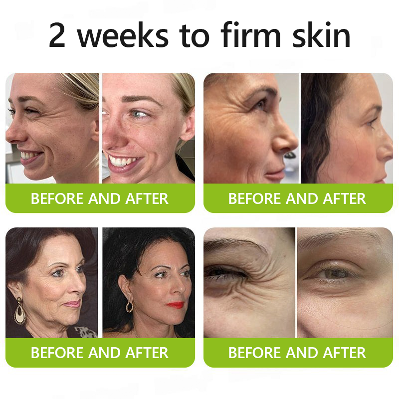 👩‍⚕️Made and shipped from NZ 🛒Healrize® Botox & Vita-A Retinol Shot Wrinkle-Lift Tightening cream - Last Day Promotion 70% OFF🛒