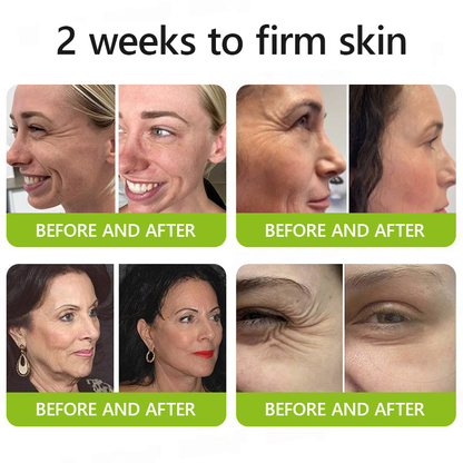 👩‍⚕️Made and shipped from NZ 🛒Healrize® Botox & Vita-A Retinol Shot Wrinkle-Lift Tightening cream - Last Day Promotion 70% OFF🛒