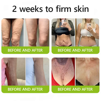 👩‍⚕️Made and shipped from NZ 🛒Healrize® Botox & Vita-A Retinol Shot Wrinkle-Lift Tightening cream - Last Day Promotion 70% OFF🛒