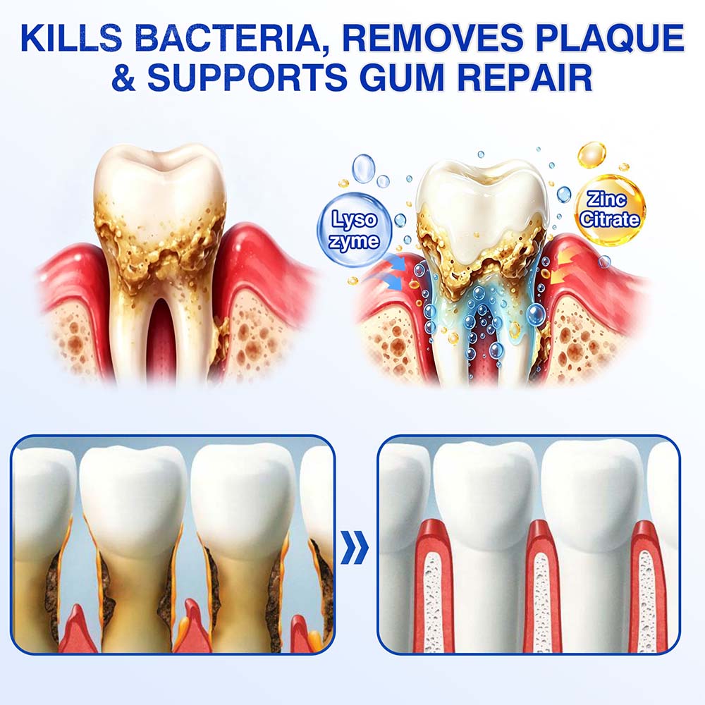 🦷Healrize® GumRevive gel for the regeneration of the tooth-supporting apparatus (for bleeding gums, receding gums, and loose teeth)🎁
