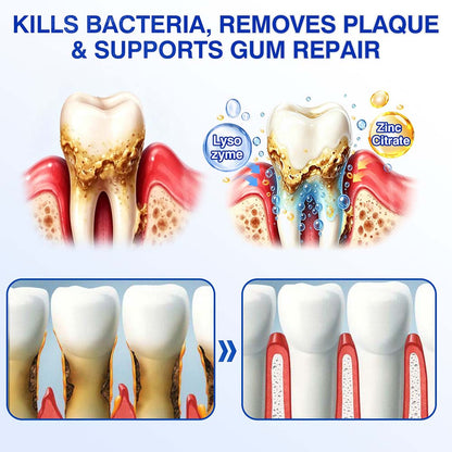 🦷Healrize® GumRevive gel for the regeneration of the tooth-supporting apparatus (for bleeding gums, receding gums, and loose teeth)🎁