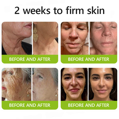 👩‍⚕️Made and shipped from NZ 🛒Healrize® Botox & Vita-A Retinol Shot Wrinkle-Lift Tightening cream - Last Day Promotion 70% OFF🛒