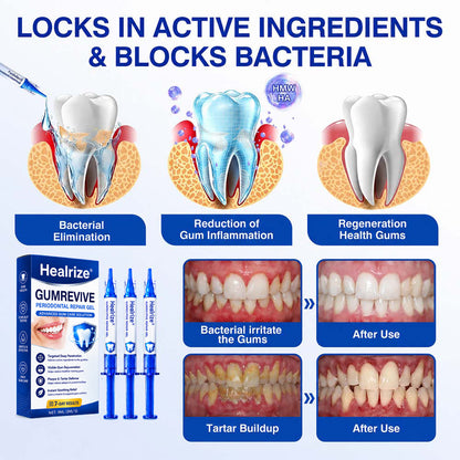 🦷Healrize® GumRevive gel for the regeneration of the tooth-supporting apparatus (for bleeding gums, receding gums, and loose teeth)🎁